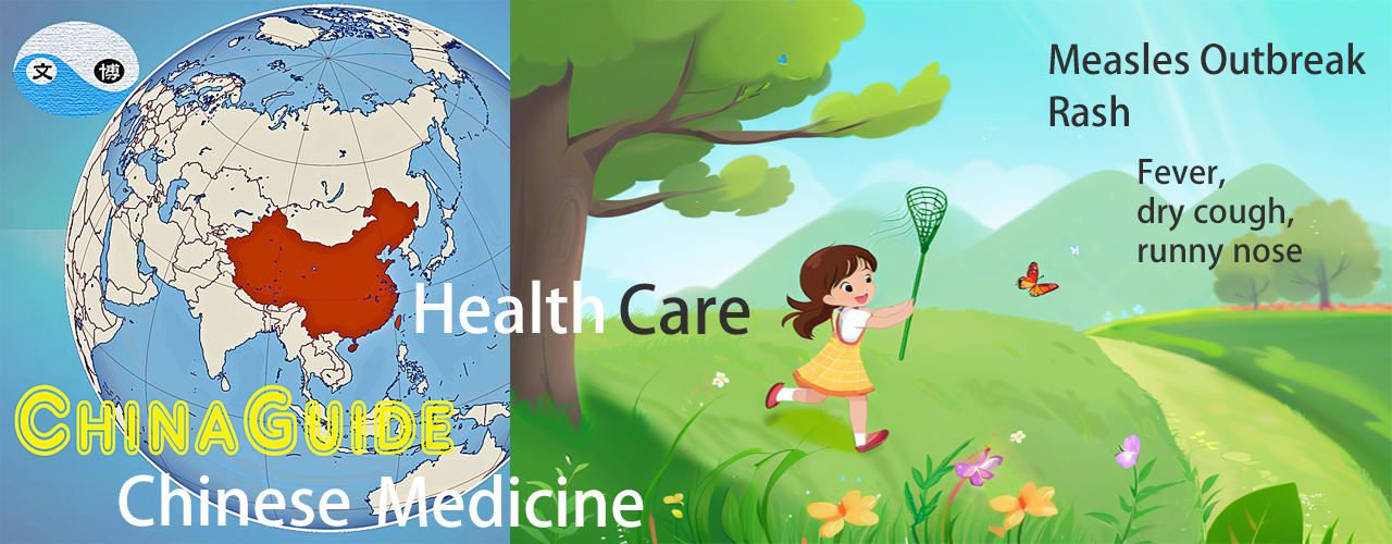 Classical Herbal Formula for Measles Outbreak